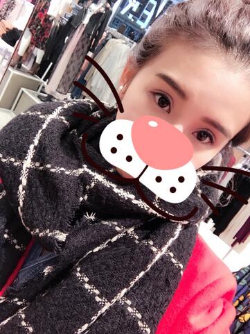 割双眼皮一个月效果,40岁割双眼皮效果好不