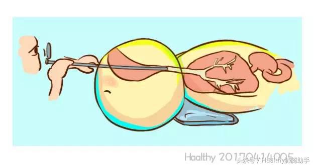 病人咳血什么体位,病人突发大咯血的急救措施