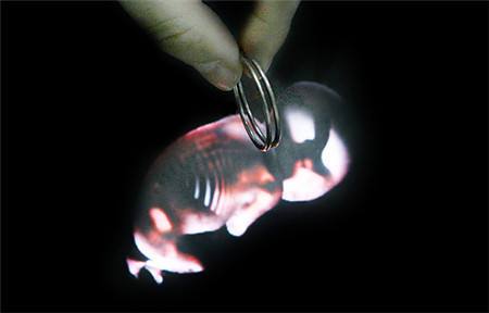 带环怀孕有出血,带环怀孕怎么办呢