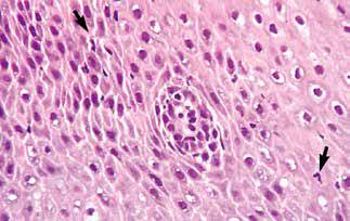 内镜做病理分析大概多久,作为一个医生太感性怎么办