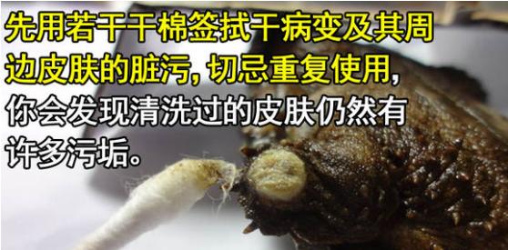帮乌龟处理疥疮全过程,乌龟长疥疮了怎么治疗