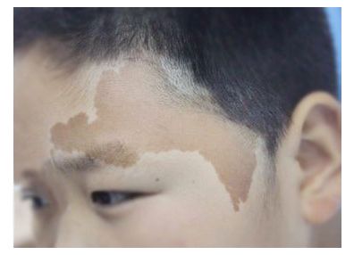 咖啡斑大讲堂，这些科普知识你不一定都知道