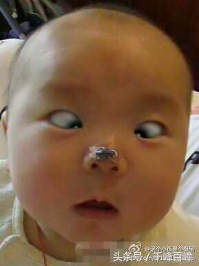可爱的宝宝斗鸡眼,你们的宝宝斗鸡眼吗