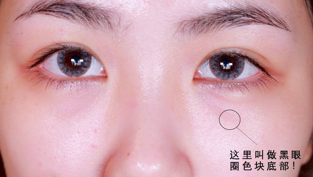 如何才是解决黑眼圈的最好方法,如何快速有效解决黑眼圈