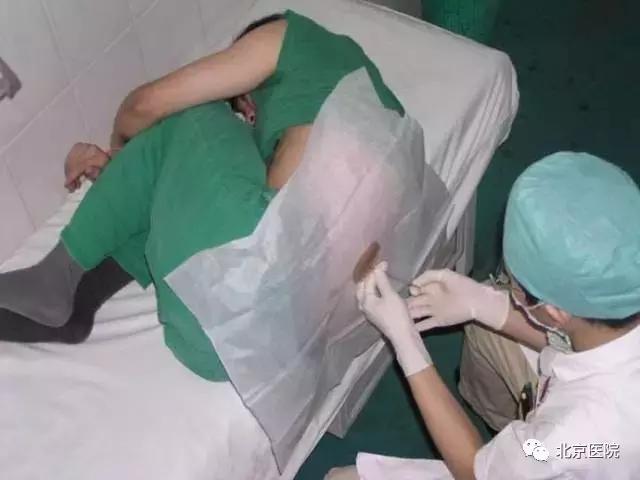 北京儿童医院神经外科脑积水,北京宣武医院神经外科脑积水