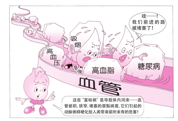 左侧股总动脉粥样斑块形成,吸烟造成动脉粥样斑块形成