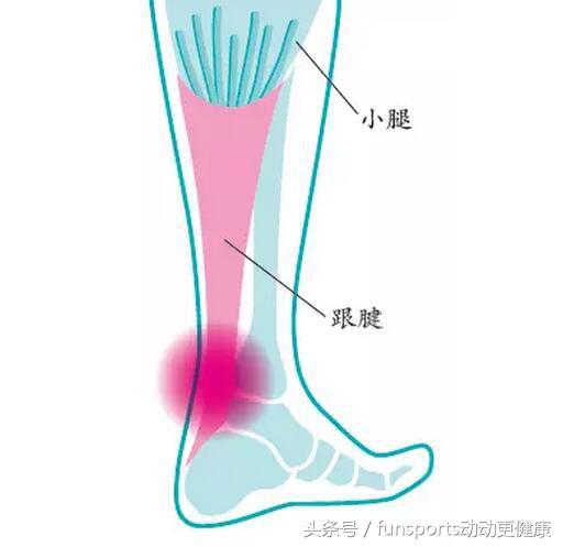 足球运动员跟腱长短重要吗,足球运动员跟腱长好不好