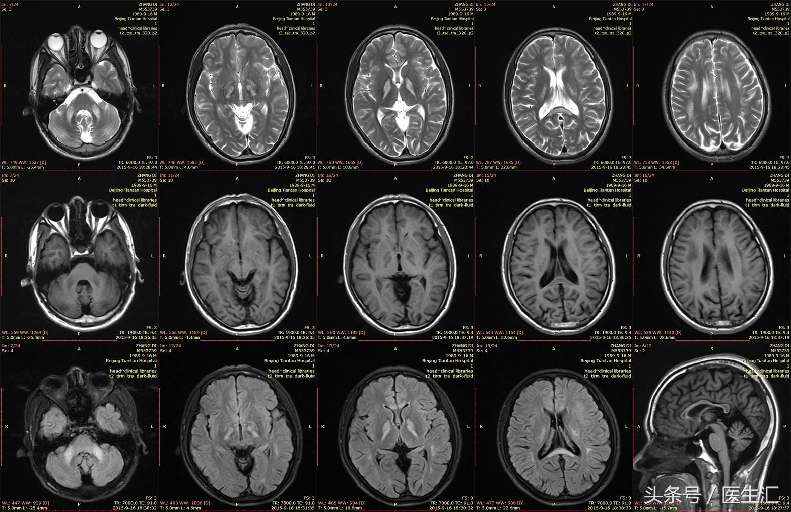 神经内科疾病诊断公式,神经系统疾病的诊断思路及步骤