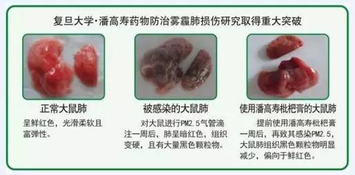 明月几时有，防霾护肺的法子必须有！