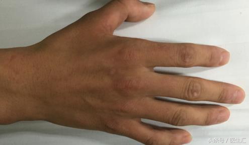 神经内科疾病诊断公式,神经系统疾病的诊断思路及步骤