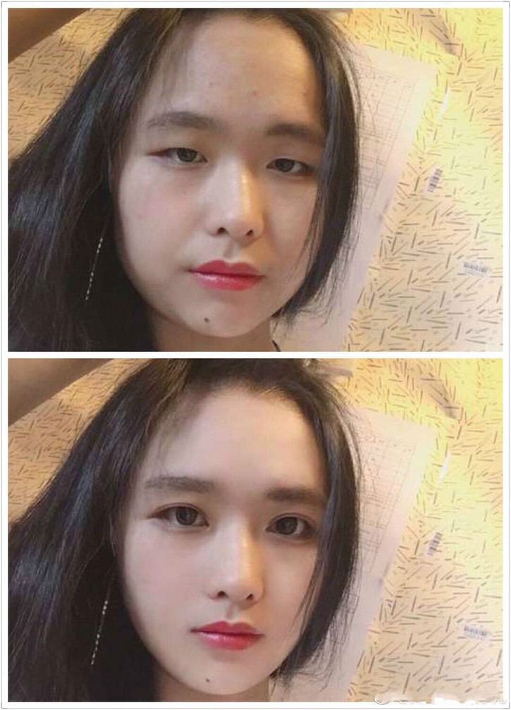 凤姐手滑点赞的东南亚整容妖术，堪比回炉再造！