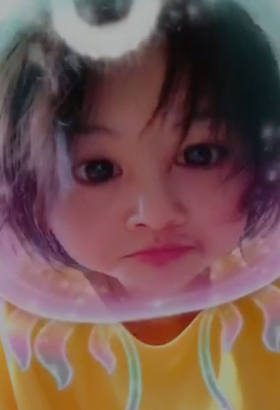 郑爽压力大深夜失眠嘴角上火，头发凌乱还不忘卖萌放飞自我！