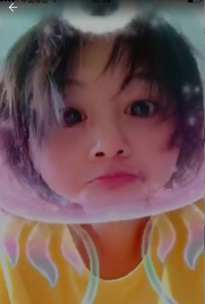 郑爽压力大深夜失眠嘴角上火，头发凌乱还不忘卖萌放飞自我！