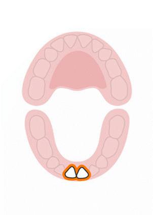 宝宝出牙期怎么缓解不适的症状,宝宝出牙期有什么症状和护理