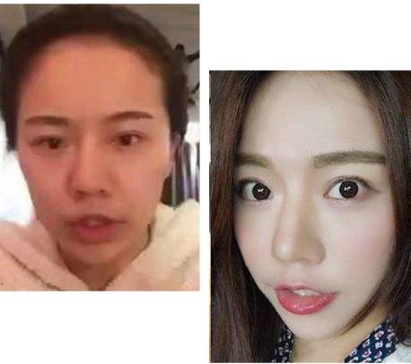 人工美胜过自然美,自然美才是真的美不要去整容