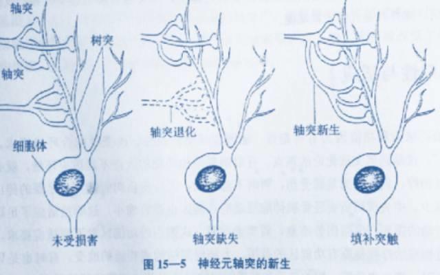 老年痴呆可以打麻将吗,玩麻将是不是可以防止老年痴呆