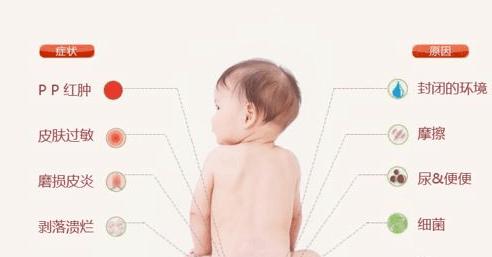 宝宝长期兜尿不湿有危害么,新生儿屁股天天兜尿不湿