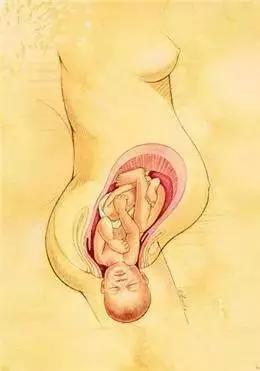 金牌助产士分娩,自然分娩过程助产士