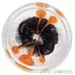 原位癌与转移癌的区别,病理如何判断原位癌和浸润性癌