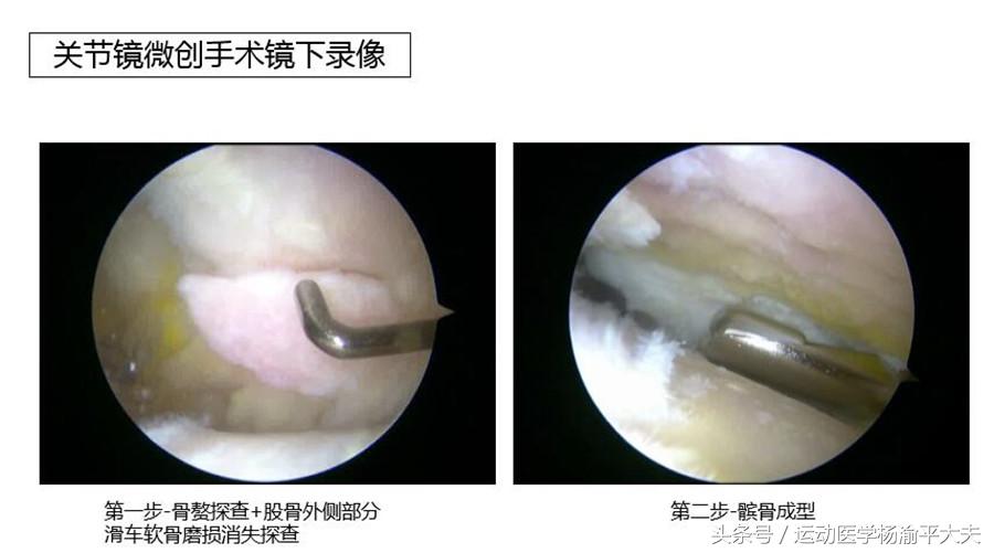 上下楼膝关节疼痛最好治疗方法,膝关节疼痛怎样上下楼能缓解疼痛
