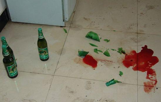 哎呀！不小心脚丫子踩到玻璃碎片上