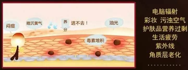 有痘痘怎么处理不留疤,有痘痘如何挤掉
