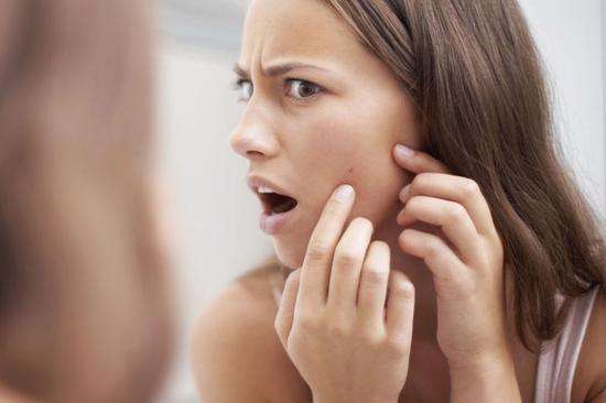 Nozuonodie“，你还在用这些药物治疗*疮痤**吗？