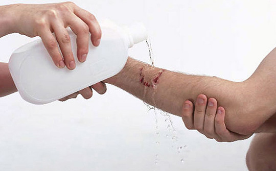 狂犬病要被发作的动物咬到才有吗,动物没有狂犬病咬人会得狂犬病吗