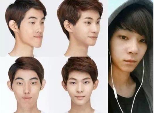 韩国整容手术恢复过程,韩国一个整容的综艺节目