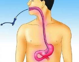 做胃镜怎么才能减轻痛苦,做胃镜有什么技巧可以减轻痛苦