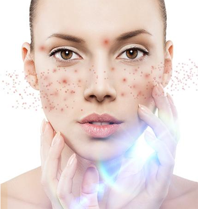 激光美肤后为啥你的效果差强人意值得一看