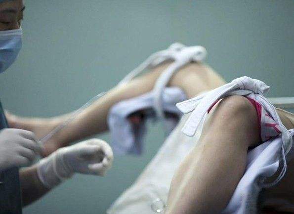 引产后的胎儿要怎么处理,引产后的胎儿自己怎么处理的