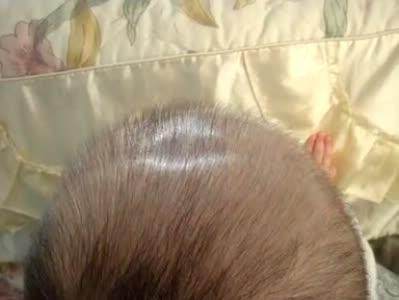 宝宝快两岁了囟门还没闭合,两岁小孩前囟门还没有闭合正常吗