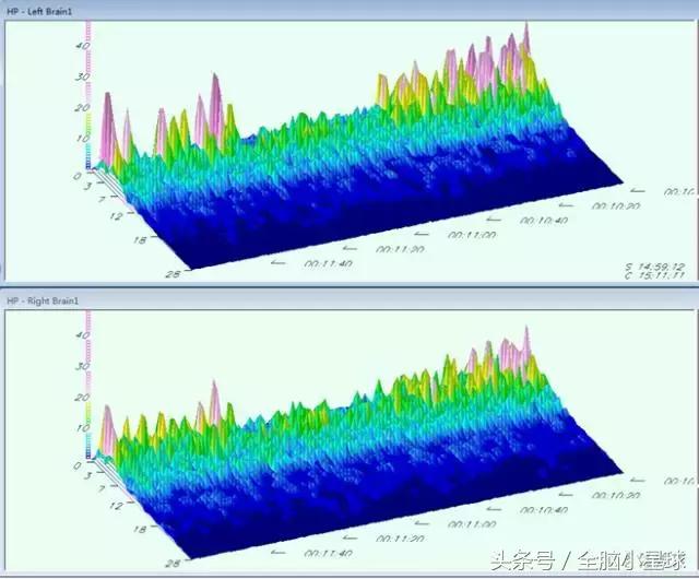 科普：脑电波和神经反馈训练