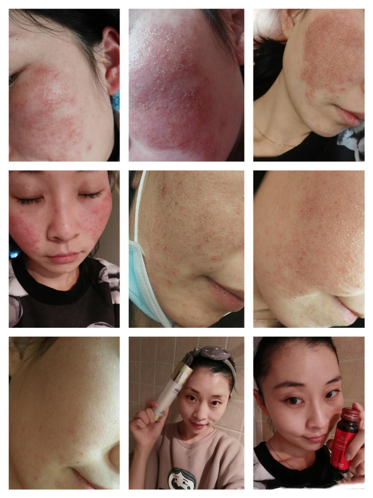 刘艳青护肤必读—肌肤出现代谢怎么处理