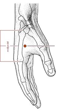 脊髓型颈椎病针灸治疗处方,神经根型颈椎病针灸绝技