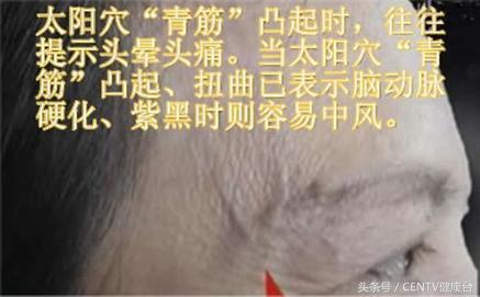 健身一段时间手背青筋明显了,健身乳房上边青筋明显是怎么回事