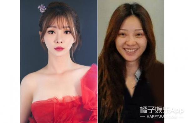 法令纹显老明星,明星怎么治法令纹