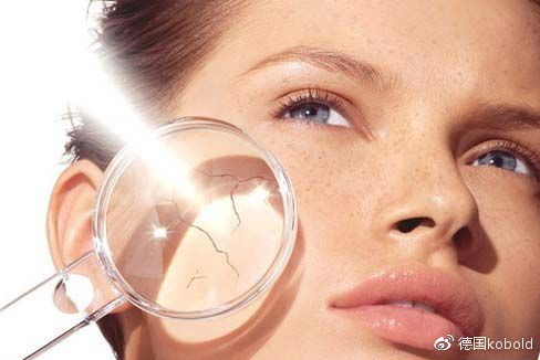 紫外线过敏怎么办呀,紫外线过敏怎么办可以去西藏吗