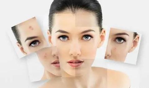 青岛修复青春痘疤痕,脸上青春痘凹陷疤痕怎么修复