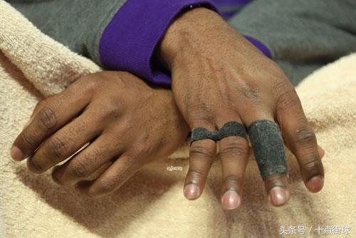 有回报必有付出，看看NBA超巨的手指脚趾，难以想象的痛苦程度