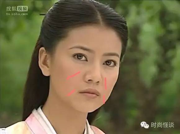 杨紫问怎么去除天生的法令纹!刘诗诗、娜扎也想知道答案啊!