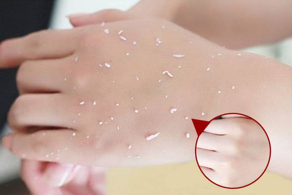 被晒得又黑又亮怎么办,如何有效美白但是无法避免晒太阳