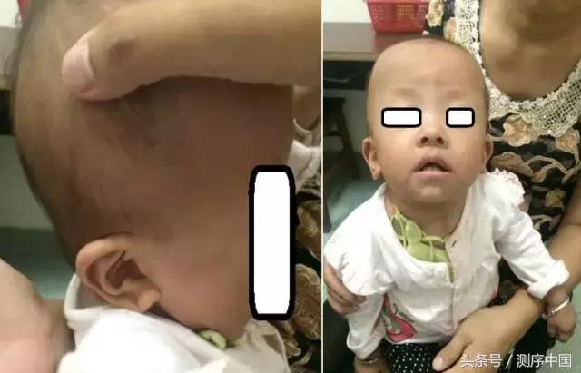 余永国儿科学博士,余永国教授