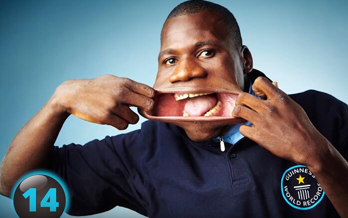 他们才是真正的超人，再大的挫折都挫不到他们，头不全又怎样