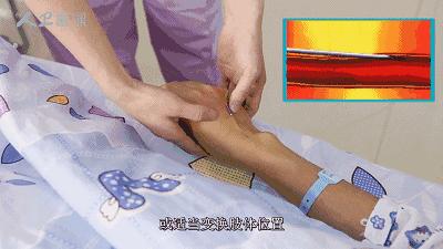 常见静脉输液故障及处理方法,静脉输液故障排除视频