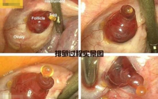 真实拍摄人类胚胎发育过程,10张图带你了解孕育全过程