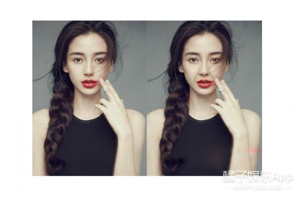 法令纹显老明星,明星怎么治法令纹