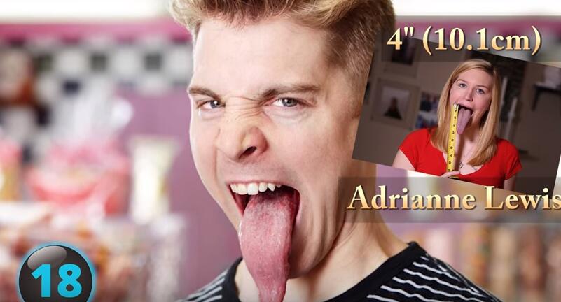 他们才是真正的超人，再大的挫折都挫不到他们，头不全又怎样