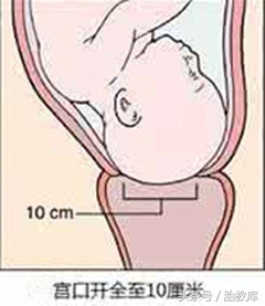 宫口从一指开到10指要多久,宫口从1指开到2指用了24小时